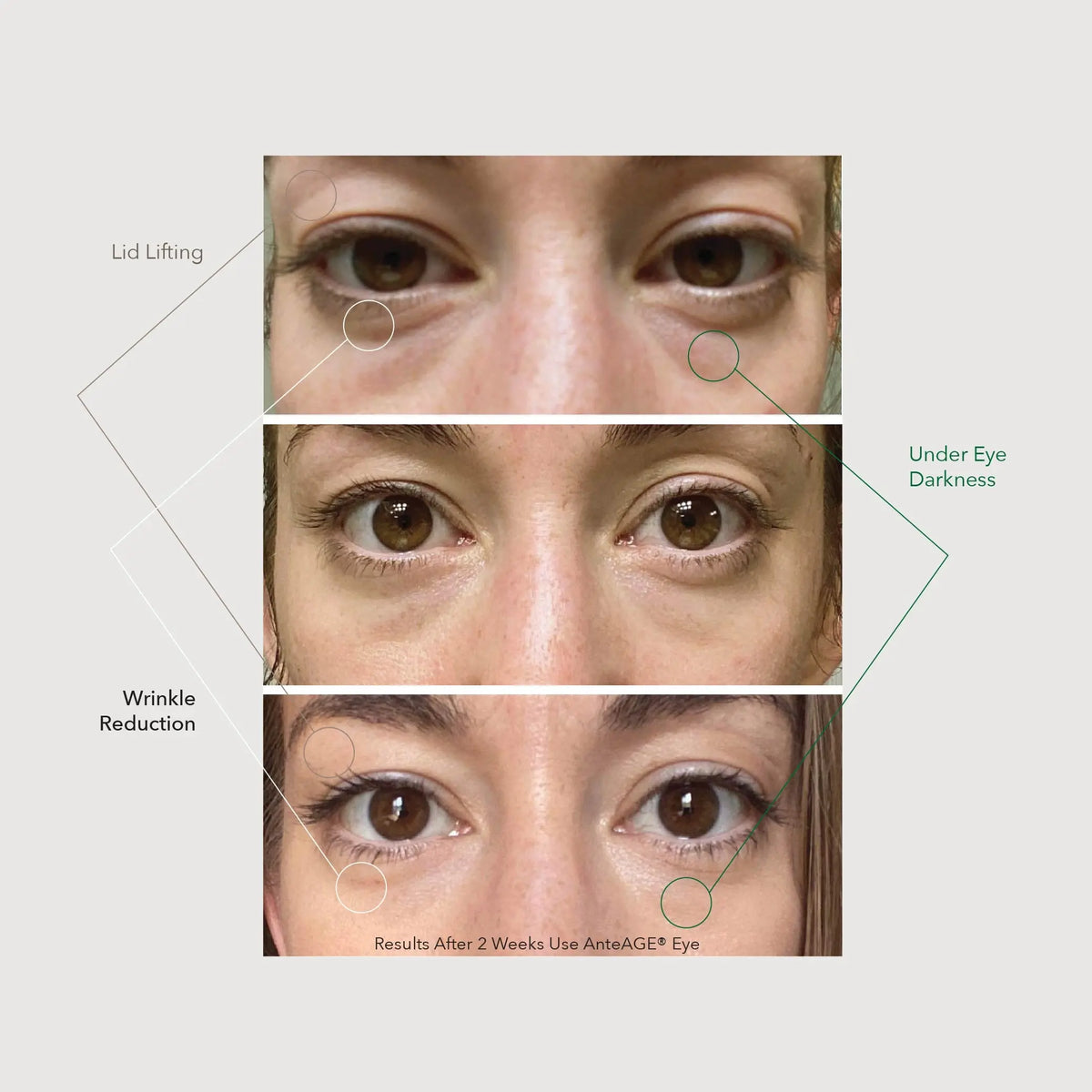 AnteAGE® Eye AnteAGE