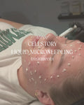3 Cellstory Liquid Microneedling Fern & Dagger