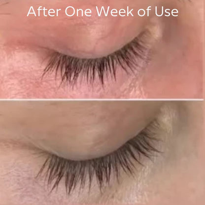 AnteAGE® Overnight Lash Serum